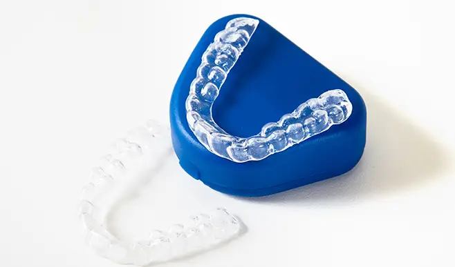 Invisible Lingual Braces